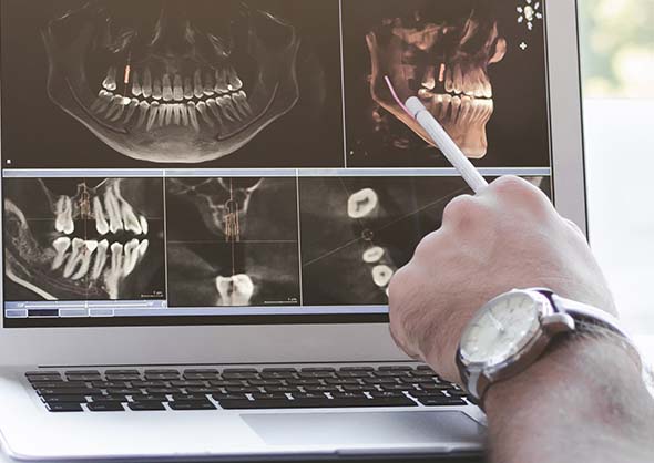 Laptop screen with X-Rays. Hand pointing at screen.